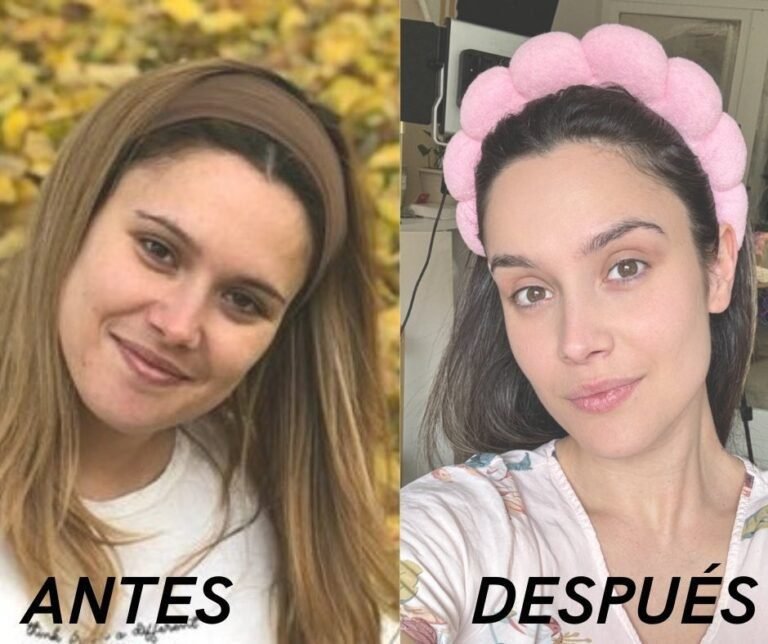 ANTES-1.jpg